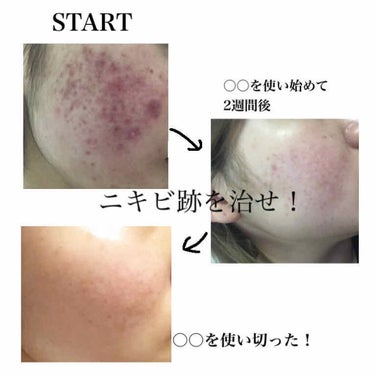 キールズ DS クリアリーブライト エッセンス[医薬部外品]/Kiehl's/美容液を使ったクチコミ（1枚目）