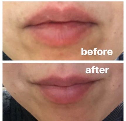 LIPS SHOT/MOTTO LAB./リップマスクを使ったクチコミ(10枚目)