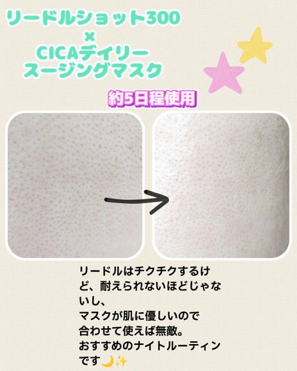 リードルショット300/VT/美容液を使ったクチコミ(4枚目)