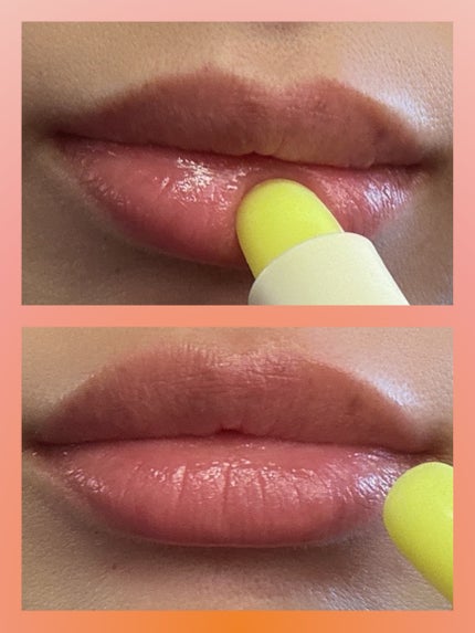 ユースキン メディカルリップスティック/ユースキン/リップクリームを使ったクチコミ(5枚目)