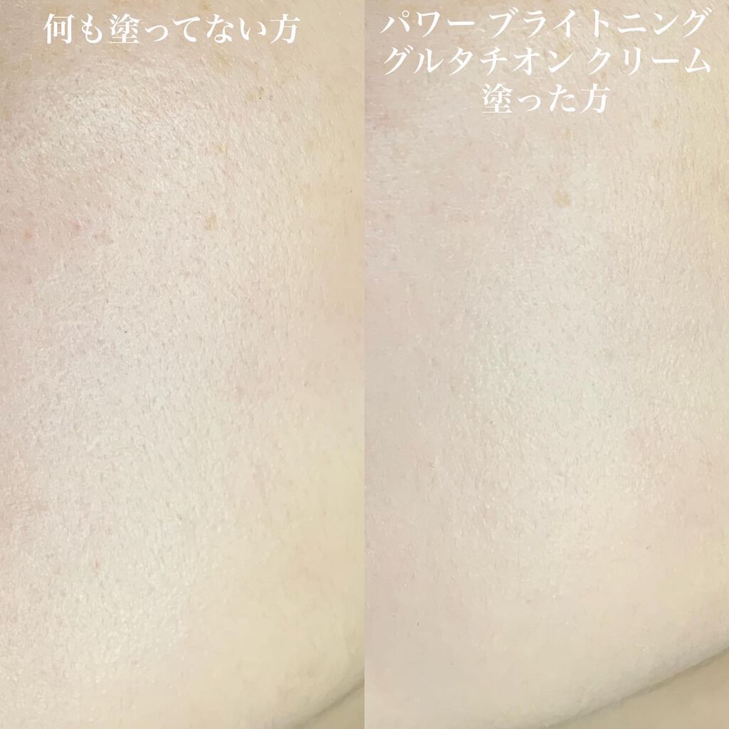 パワーブライトニング グルタチオンクリーム/Dr.Althea/フェイスクリームを使ったクチコミ(5枚目)