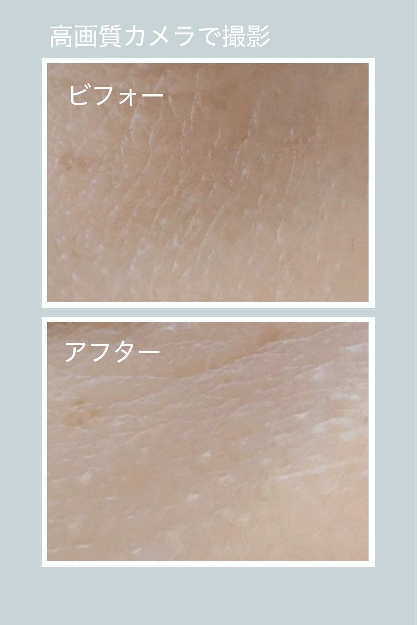 5GF リフティナル ターンオーバー 美容液/Mildlab/美容液を使ったクチコミ(2枚目)