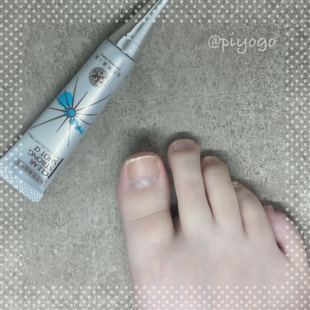 薬用 クリアストロングショット アルファ/北の快適工房/レッグ・フットケアを使ったクチコミ（2枚目）