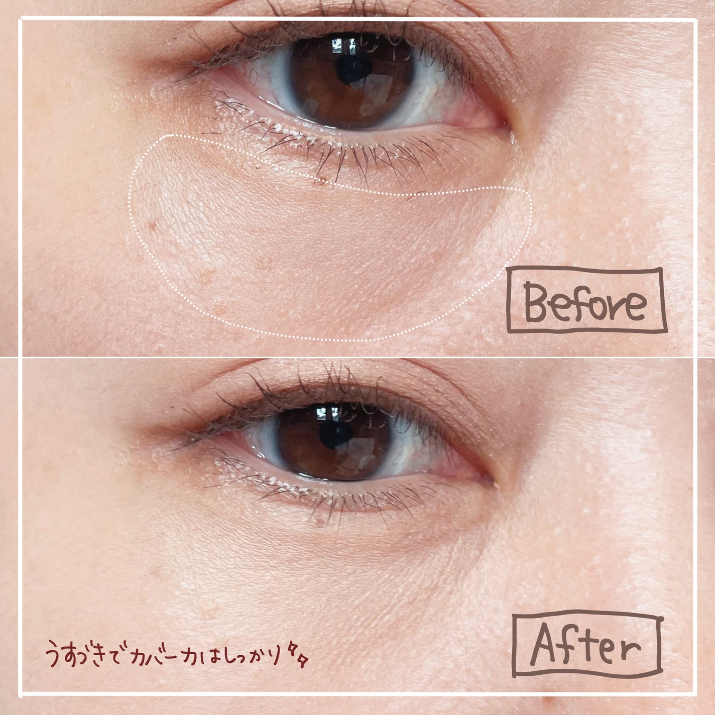 エテュセ スキンフィット カバーコンシーラー/ettusais/クリームコンシーラーを使ったクチコミ(3枚目)