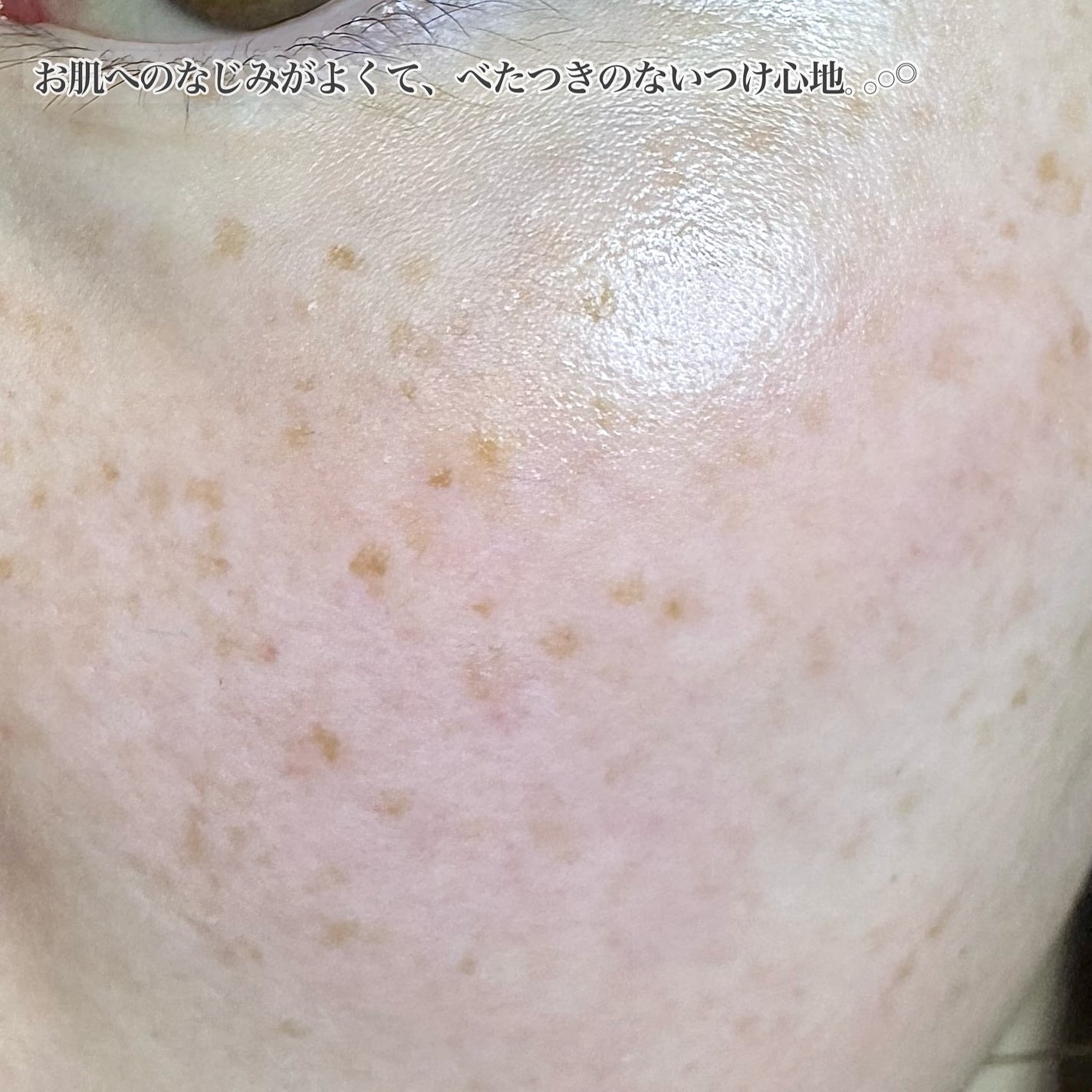 レチ二オールポアタイトニングセラム/Real Barrier/美容液を使ったクチコミ(4枚目)