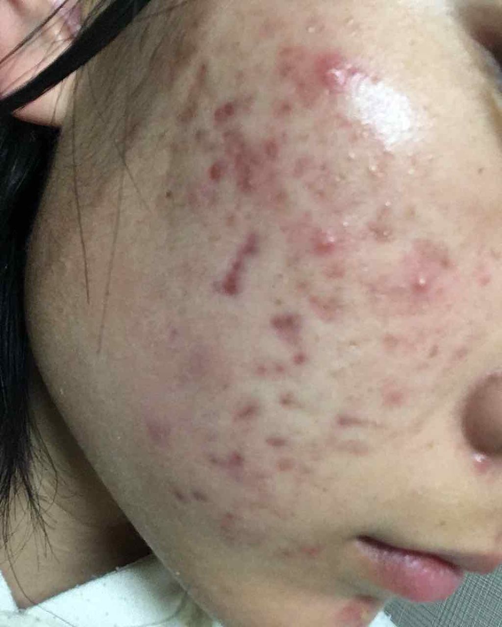 7 day Special Set プログラム3/b.glen/トライアルキットを使ったクチコミ(2枚目)