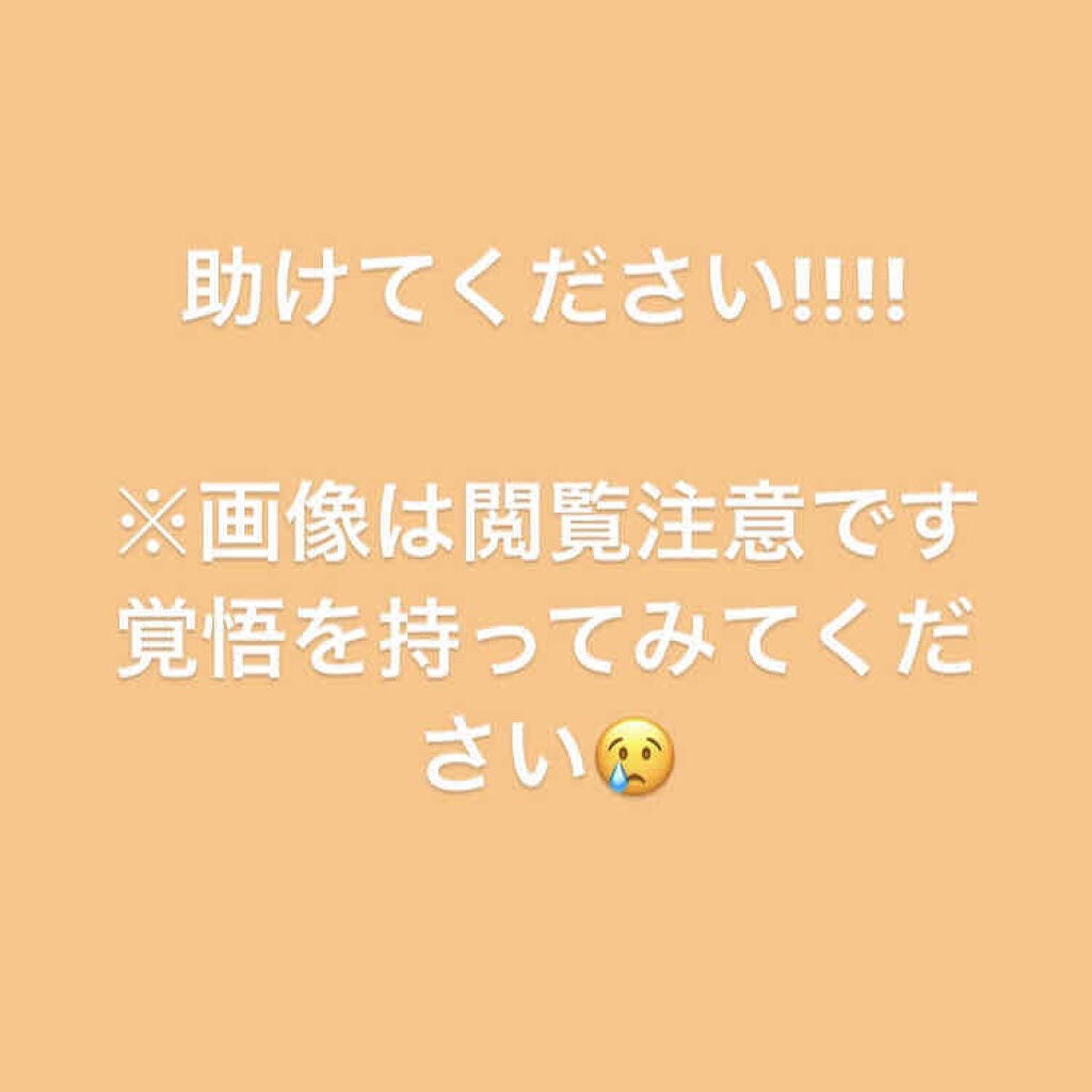 ECO on LIPS 「助けてください!!!!初投稿がお見苦しいものになってしまいまし..」(1枚目)