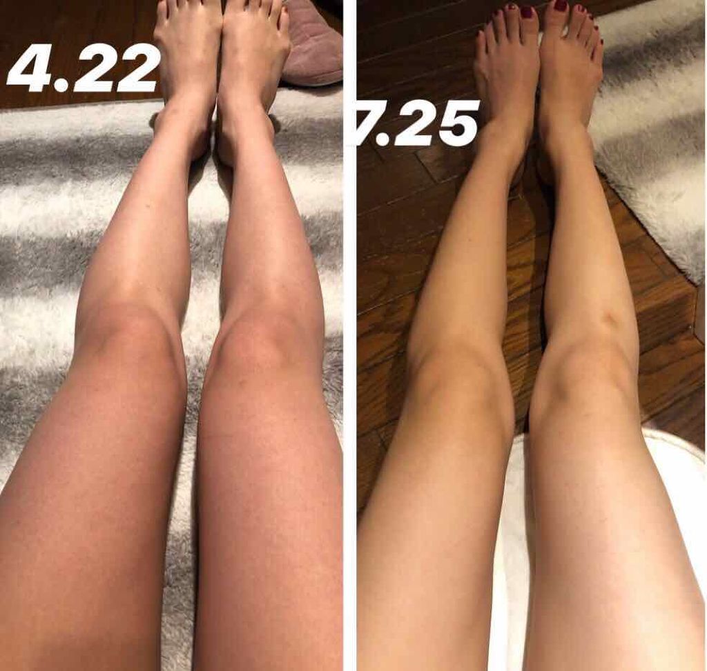 美白になる方法 ベビーパウダーeピンク缶 ピジョンの美白効果 使い方 3ヶ月の変化 足の甲の By Beee 敏感肌 30代前半 Lips