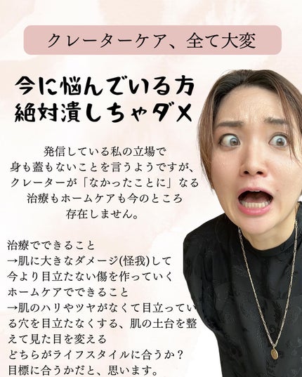 おゆみ|ニキビ・ニキビ跡ケア on LIPS 「@______ohyoume他の投稿はこちらから!【クレーター..」(8枚目)