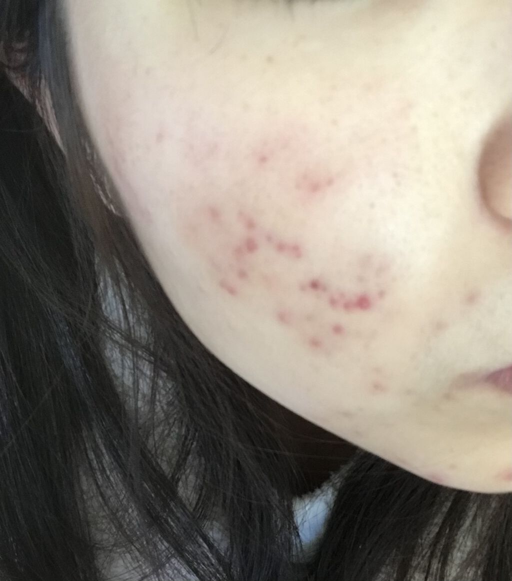 化粧水・敏感肌用・高保湿タイプ/無印良品/化粧水を使ったクチコミ（3枚目）