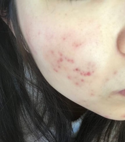 化粧水・敏感肌用・高保湿タイプ/無印良品/化粧水を使ったクチコミ(3枚目)