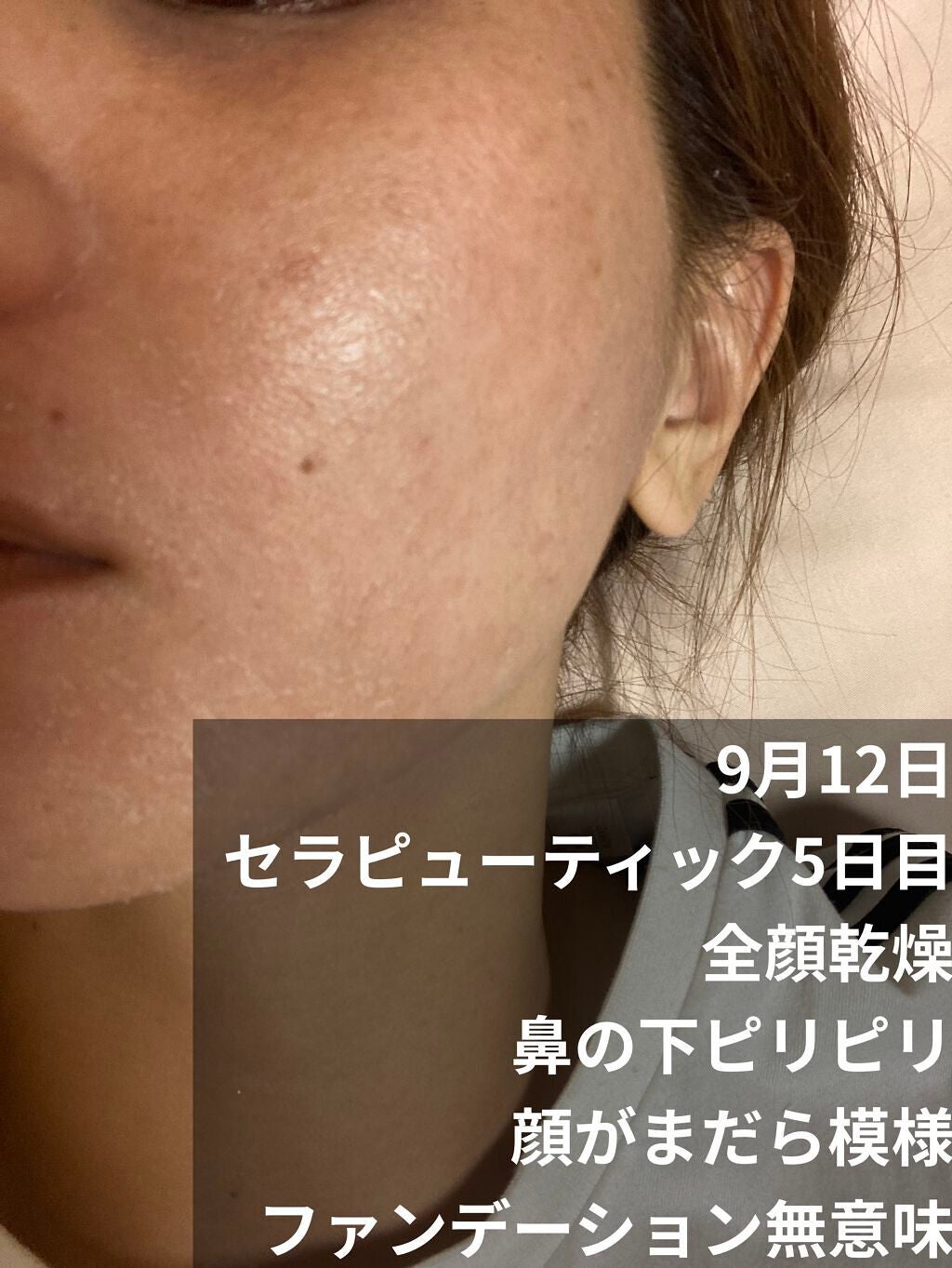 ミラミックス/ZO Skin Health/フェイスクリームを使ったクチコミ(2枚目)