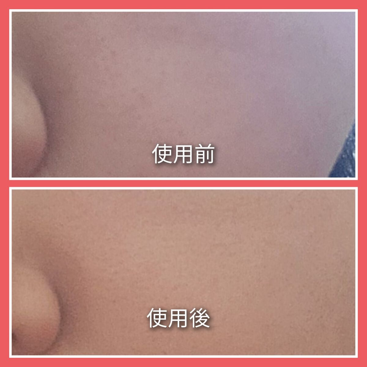 スキンライトセラピーII/Makeon/美顔器・マッサージを使ったクチコミ(3枚目)