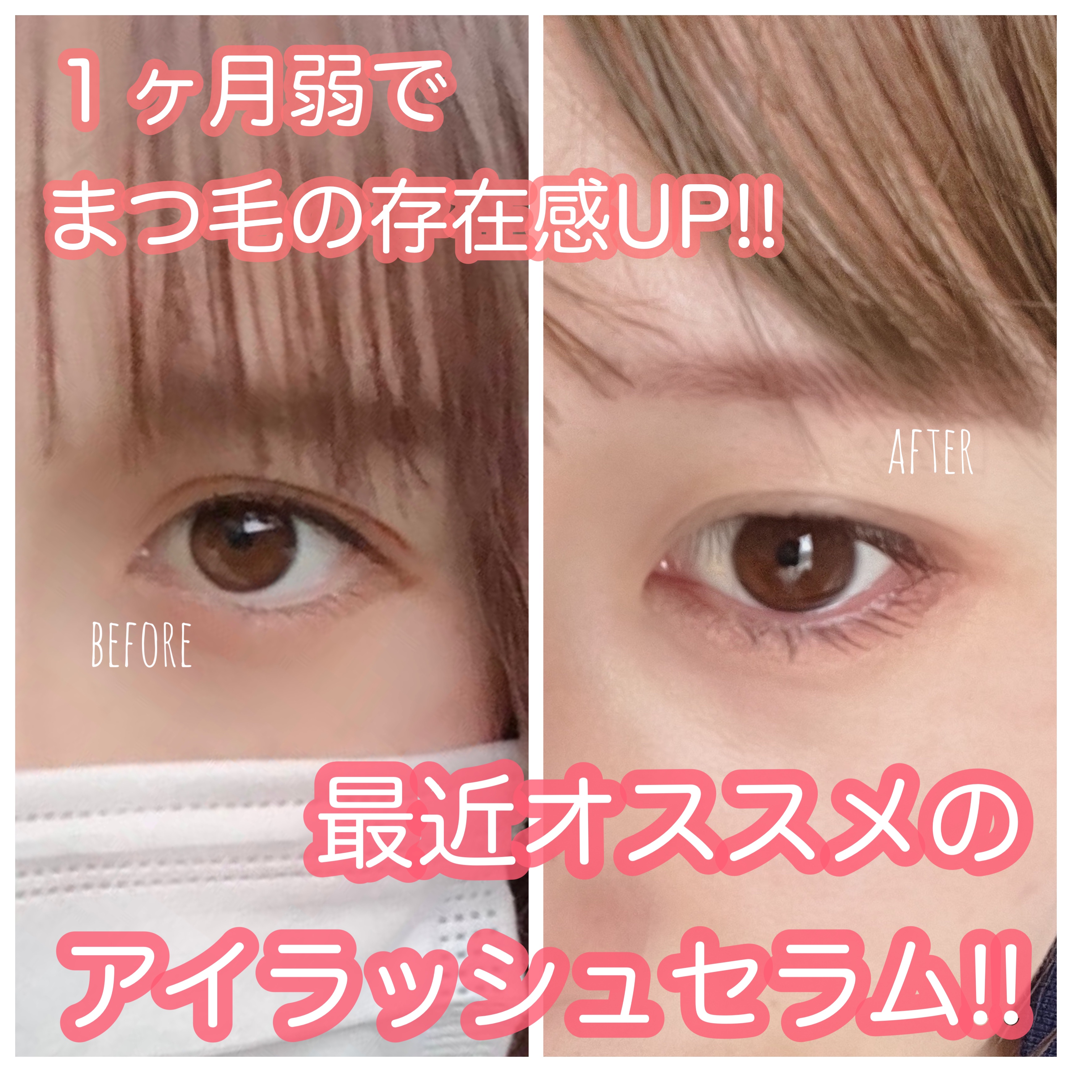 アイラッシュセラム/VIYEUX/まつげ美容液を使ったクチコミ（1枚目）