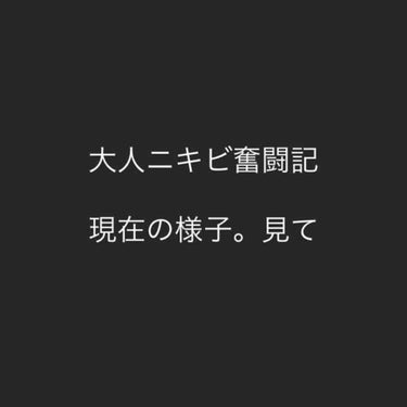 ドクタージャルト シカペア クリーム （第2世代）/Dr.Jart＋/フェイスクリームを使ったクチコミ（1枚目）