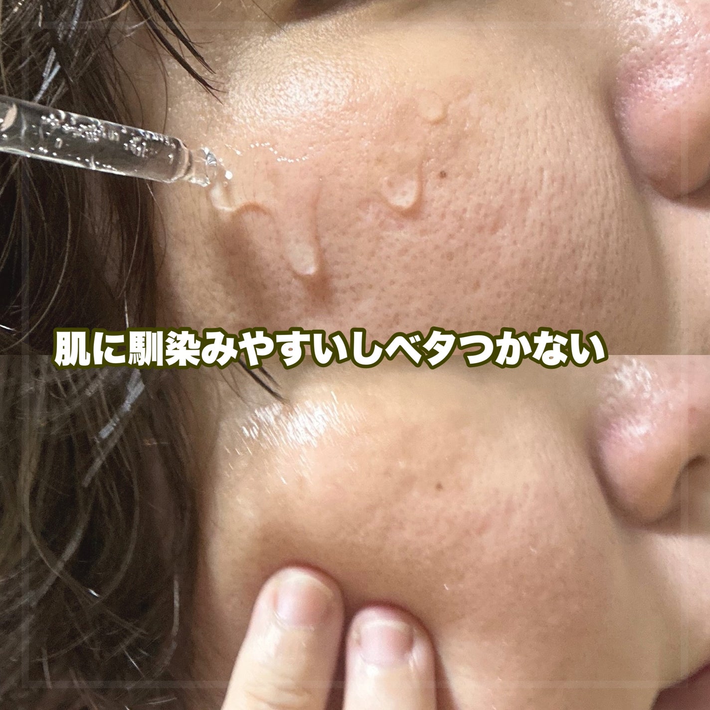 ティーツリー トラブルパッド/MEDIHEAL/トナーパッドを使ったクチコミ(4枚目)