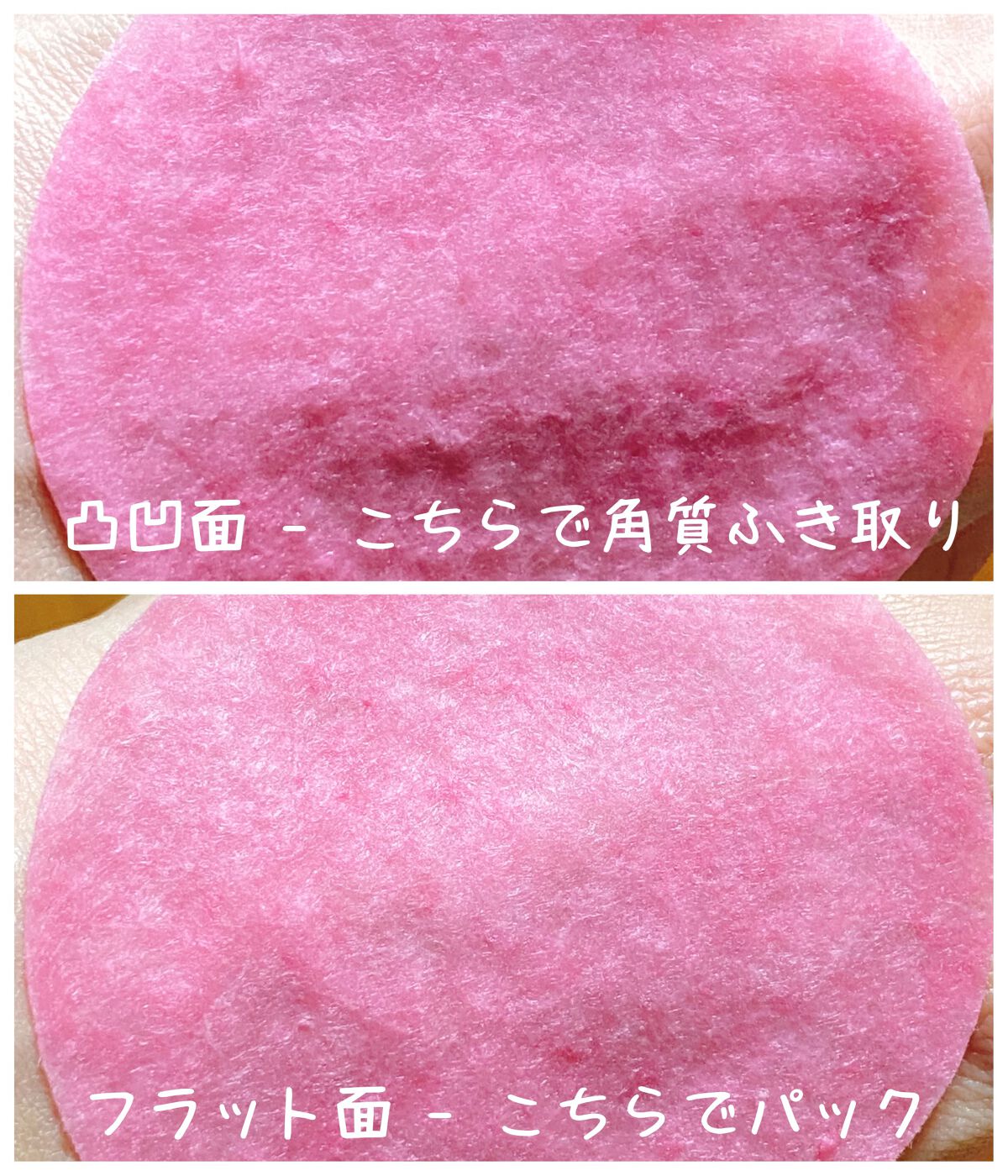 マデセラピンクアロエビルダートナーパッド/SKINRx LAB/トナーパッドを使ったクチコミ（2枚目）