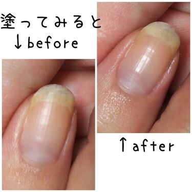 七星天灯 On Lips ルシャネイルリペアクリーム自爪を健康にしたい不健康爪のみんな Lips