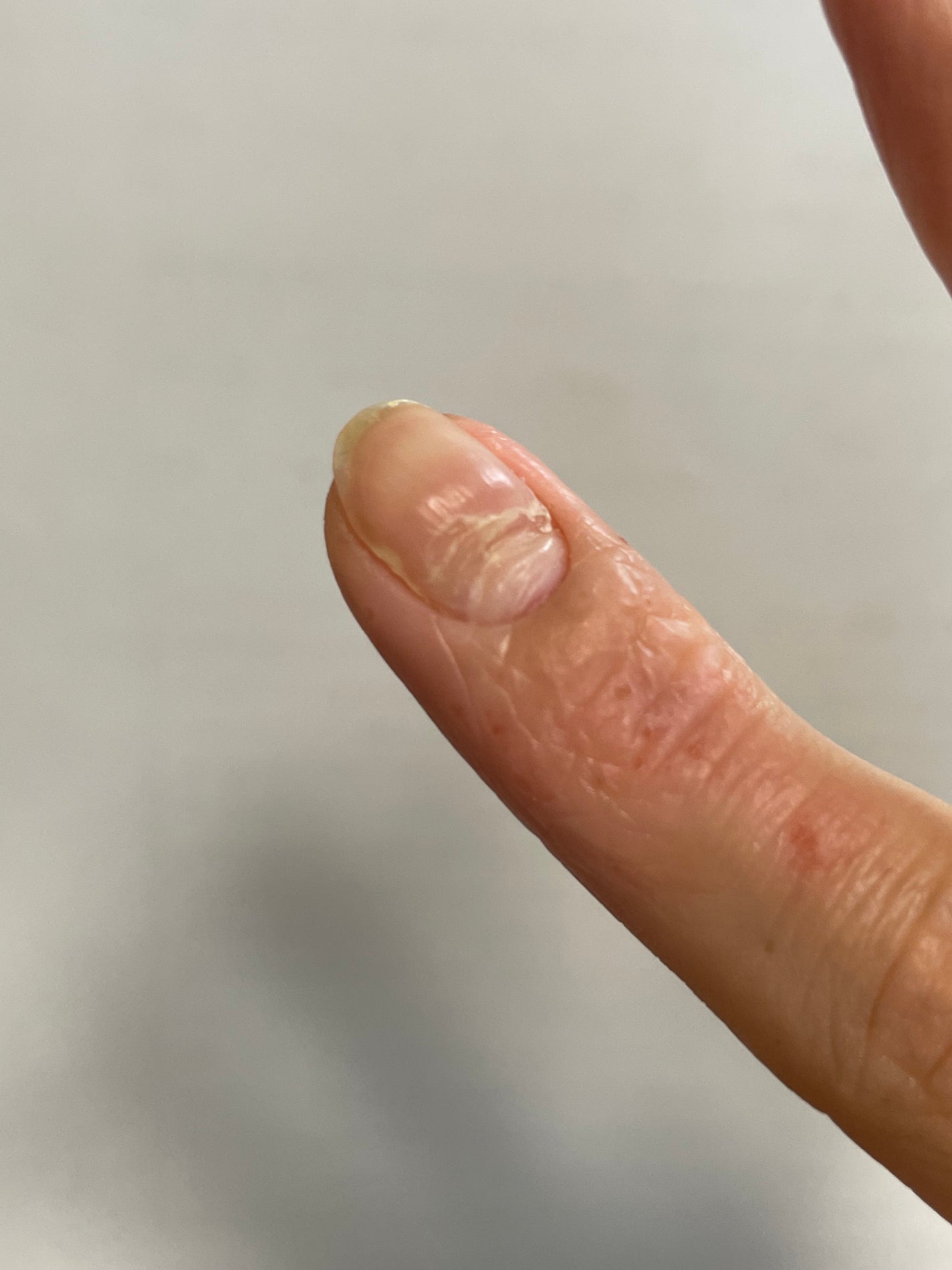 ニベアクリーム/ニベア/ボディクリームを使ったクチコミ(3枚目)