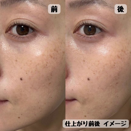 エンリッチ メディカリフト デュオセラム/ドクターシーラボⓇ/美容液を使ったクチコミ(5枚目)