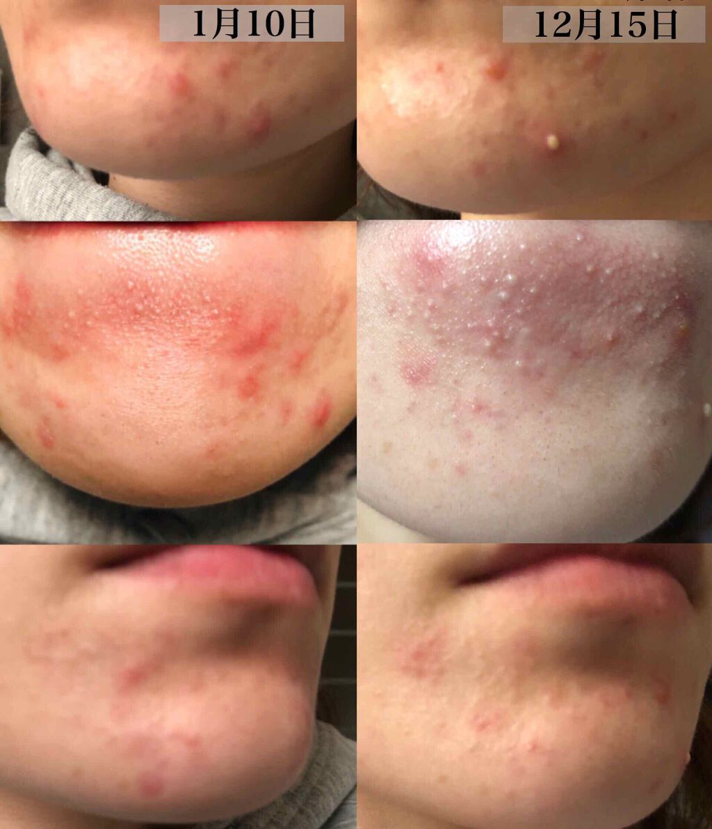 ディアナチュラスタイル ヘム鉄×葉酸+ビタミンB6・B12・C/Dear-Natura (ディアナチュラ)/食品を使ったクチコミ(2枚目)