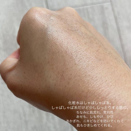 ヘパトリート 薬用保湿化粧水/ゼトックスタイル/化粧水を使ったクチコミ(3枚目)