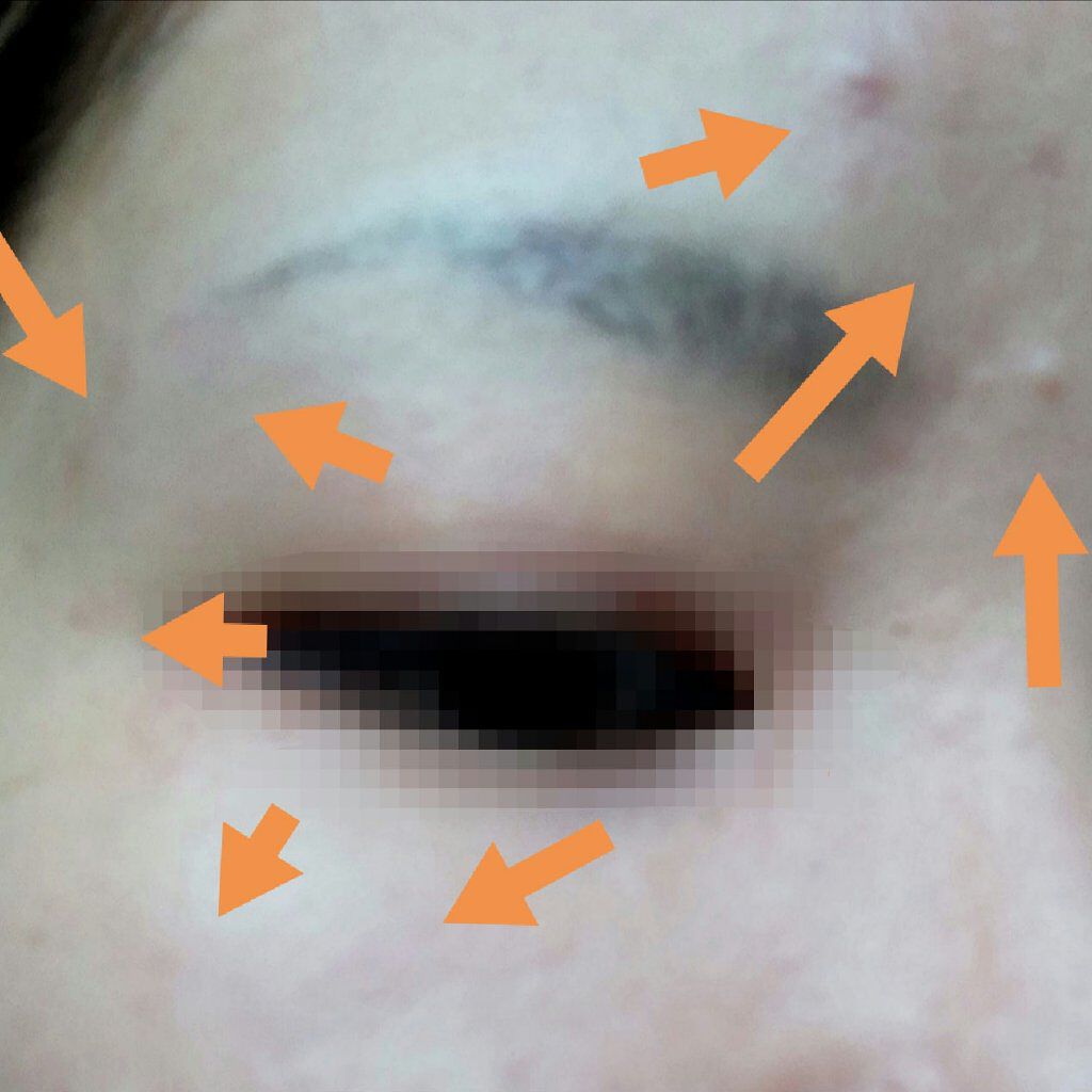 カバーパーフェクション チップコンシーラー/the SAEM/リキッドコンシーラーを使ったクチコミ(3枚目)