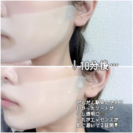 カーミングリペア若葉のシカスポットパッド/Luvum/トナーパッドを使ったクチコミ(5枚目)