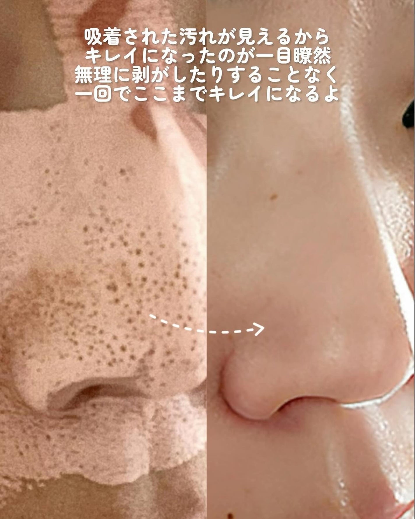 カロテン毛穴レスクレイパック/APRILSKIN/洗い流すパック・マスクを使ったクチコミ(8枚目)