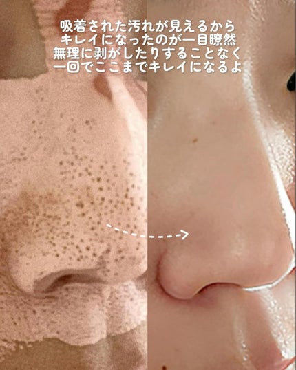カロテン毛穴レスクレイパック/APRILSKIN/洗い流すパック・マスクを使ったクチコミ(8枚目)