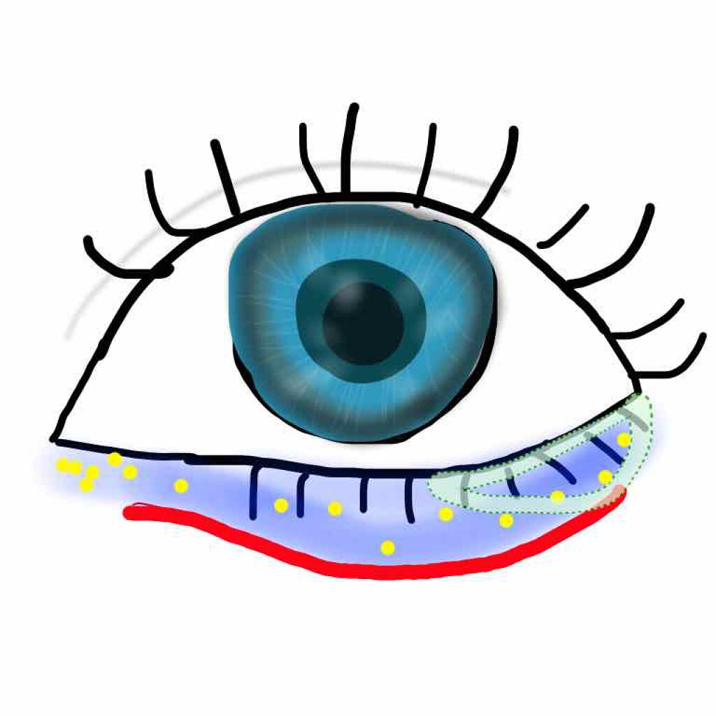 グリッターゾーン CRASH #10 CANDY PINK/lilybyred/グリッターを使ったクチコミ（2枚目）