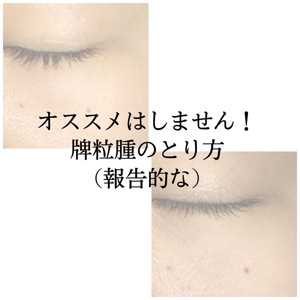 DETクリア ブライト&ピール ピーリングジェリー<ミックスフルーツの香り>/Detclear/ピーリングを使ったクチコミ(1枚目)