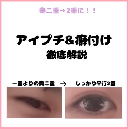 アイテープ(絆創膏タイプ、レギュラー、70枚)/DAISO/二重まぶた用アイテムを使ったクチコミ(1枚目)