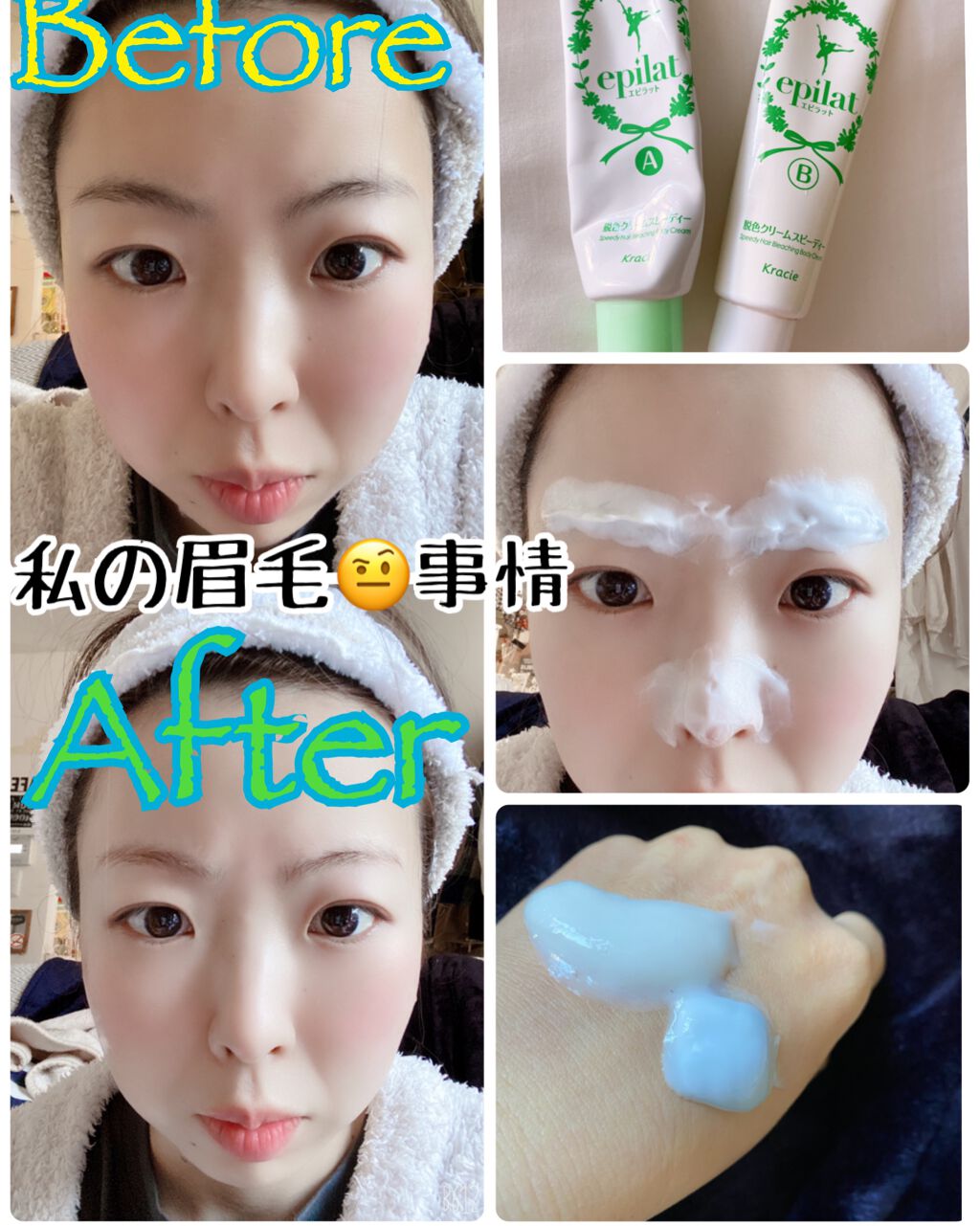 脱色クリーム スピーディー/エピラット/ムダ毛ケアを使ったクチコミ（1枚目）
