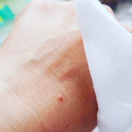 薬用 雪肌精/雪肌精/化粧水を使ったクチコミ(7枚目)