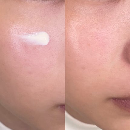 エファクラ ピールケア セラム/ラ ロッシュ ポゼ/美容液を使ったクチコミ(6枚目)