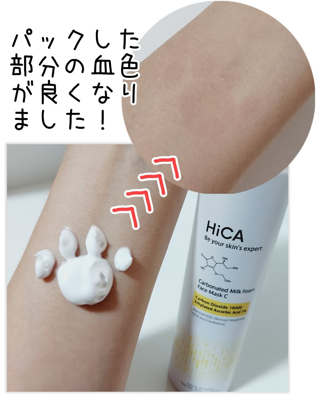 HiCA 炭酸ミルク泡パックC 18000/HiCA/洗い流すパック・マスクを使ったクチコミ(3枚目)