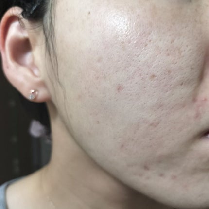 ビオオイル アルガンオイル/Melvita/フェイスオイルを使ったクチコミ(1枚目)