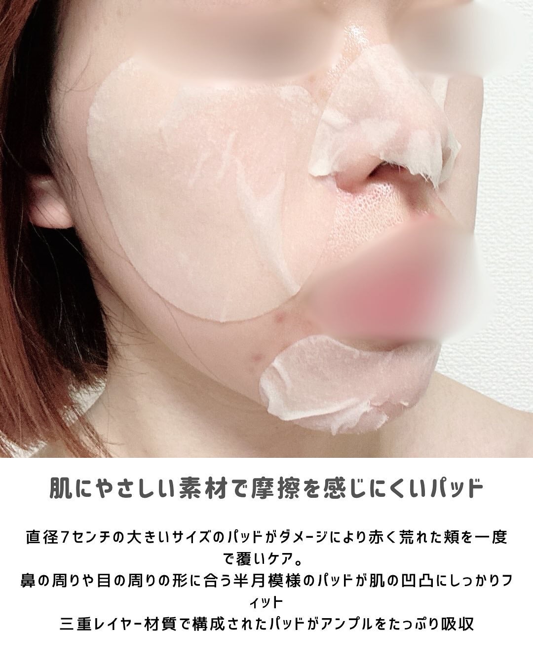 センテラ クイックカーミングパッド/SKIN1004/トナーパッドを使ったクチコミ(4枚目)