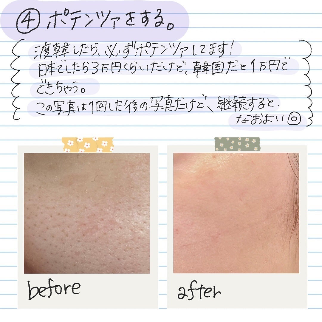 デイリーPD/ZO Skin Health/フェイスクリームを使ったクチコミ(5枚目)