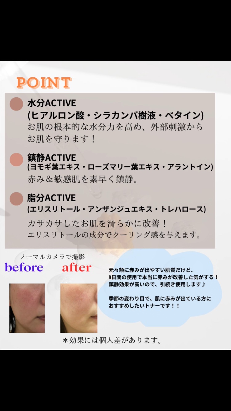 ナイントナー/Dr.Twenty Project/化粧水を使ったクチコミ（3枚目）