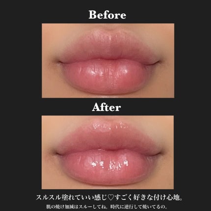 ダーマパワーX リップエッセンス/オバジ/リップ美容液を使ったクチコミ(3枚目)