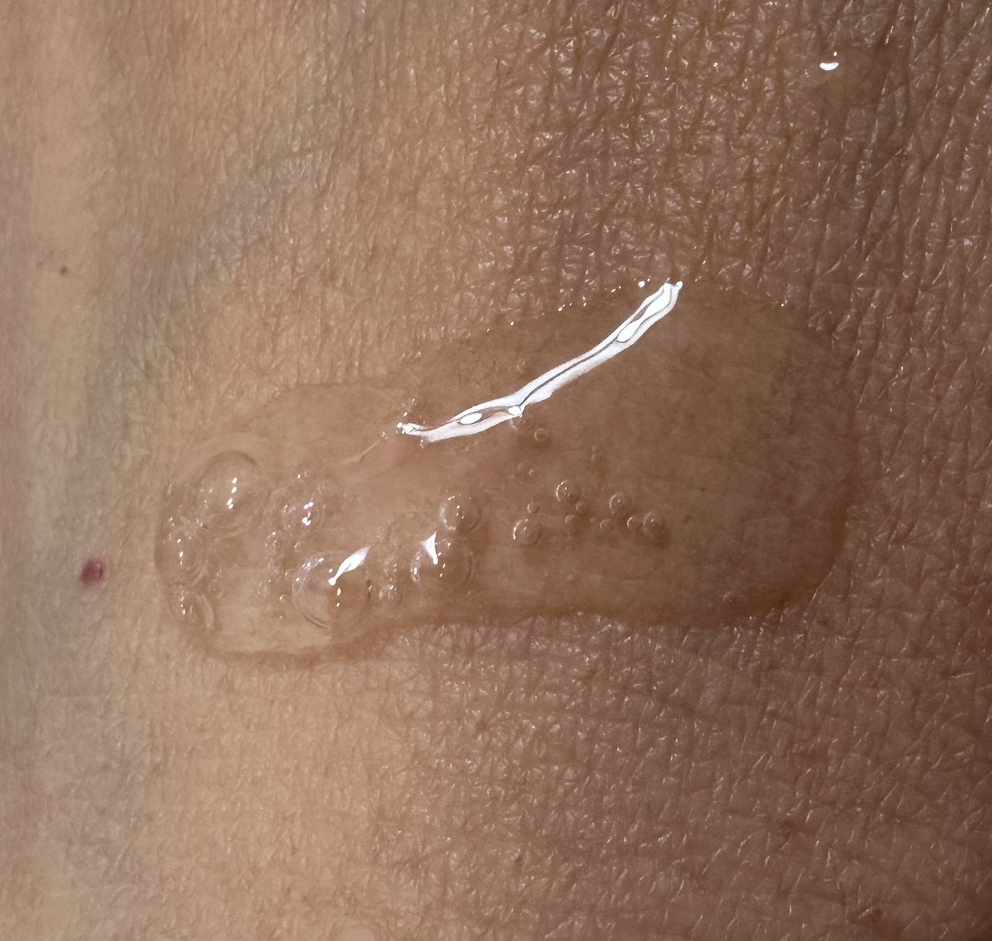 レチノール×シカ バウンスボールセラム/LIALUSTER/美容液を使ったクチコミ(3枚目)