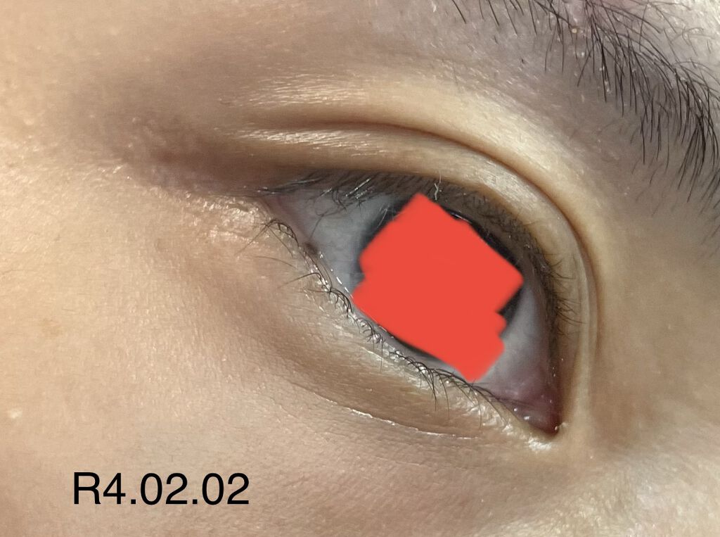  ピュアショット アイセラム/YVES SAINT LAURENT BEAUTE/アイケア・アイクリームを使ったクチコミ（1枚目）