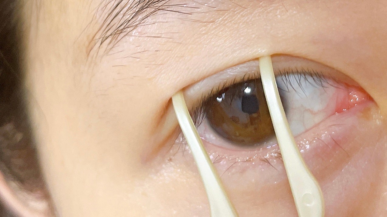 TWOOL ダブルアイリッドグルー/SHOBIDO/二重まぶた用アイテムを使ったクチコミ(3枚目)