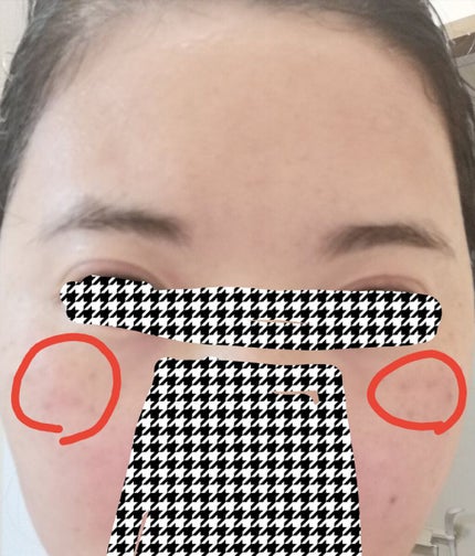 薬用ローション(とてもしっとり)/IHADA/化粧水を使ったクチコミ(7枚目)