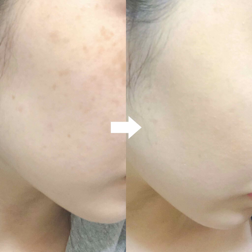 カバーパーフェクション チップコンシーラー/the SAEM/リキッドコンシーラーを使ったクチコミ（2枚目）