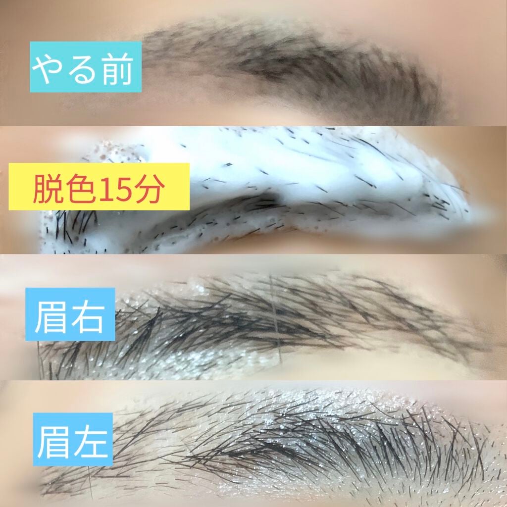 脱色クリーム 敏感肌用/エピラット/ムダ毛ケアを使ったクチコミ(2枚目)