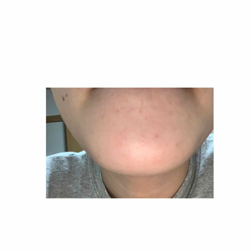 潤浸保湿 フェイスクリーム/キュレル/フェイスクリームを使ったクチコミ(3枚目)