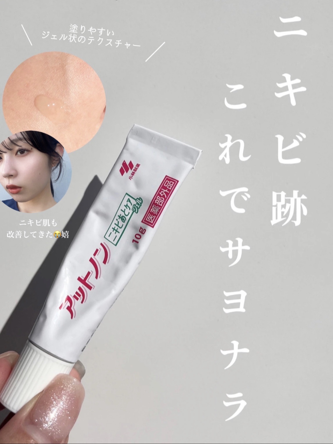 ニキビあとケアジェル/アットノン/その他スキンケアを使ったクチコミ（1枚目）